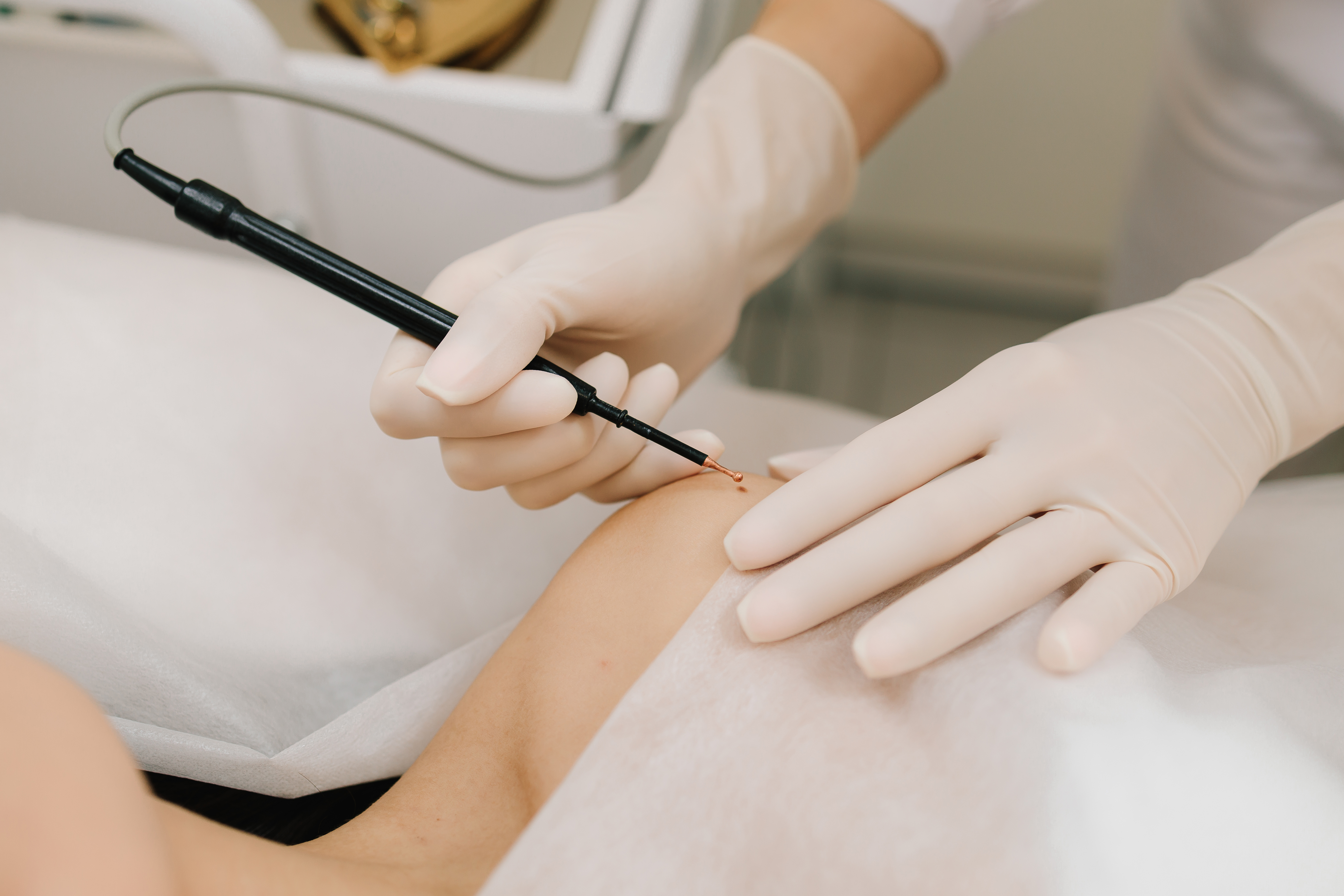 Un metge sosté un bisturí sobre un pacient.