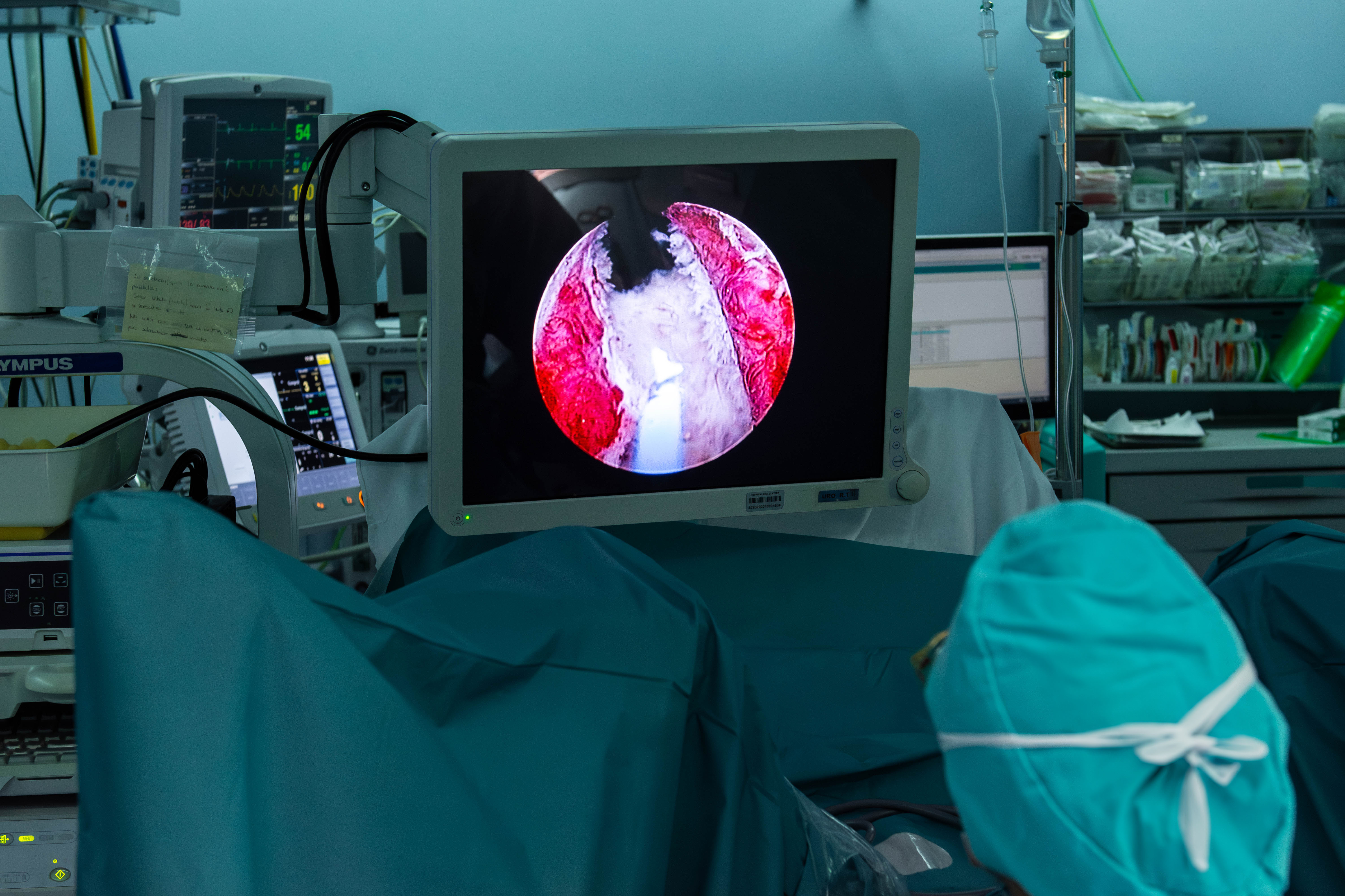 Una cirurgiana observa una operació a través d'una pantalla